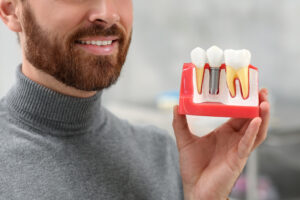 Man holding educational model of dental implant on blurred background, closeup.